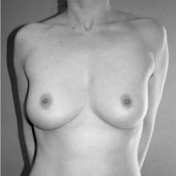 Binder Poitrine Long - Blanc -Lingerie Soldes Boutique chestbinderbusteseinsface 1 10